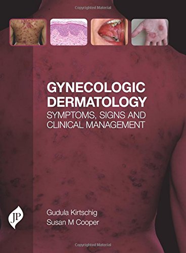 Gynecologic-Dermatology-Symptoms-Signs-and-Clinical-Management-1st-Edition-SZqSG-image