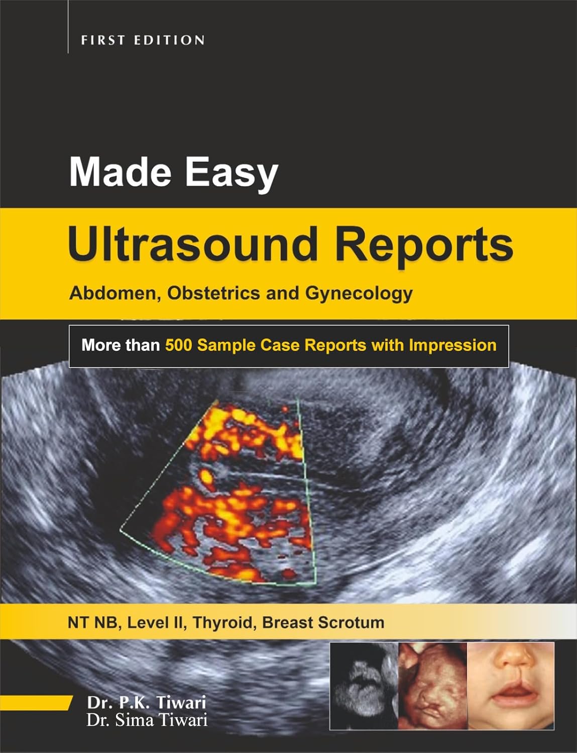 Made-Easy-Ultrasound-Reports-f1D9x