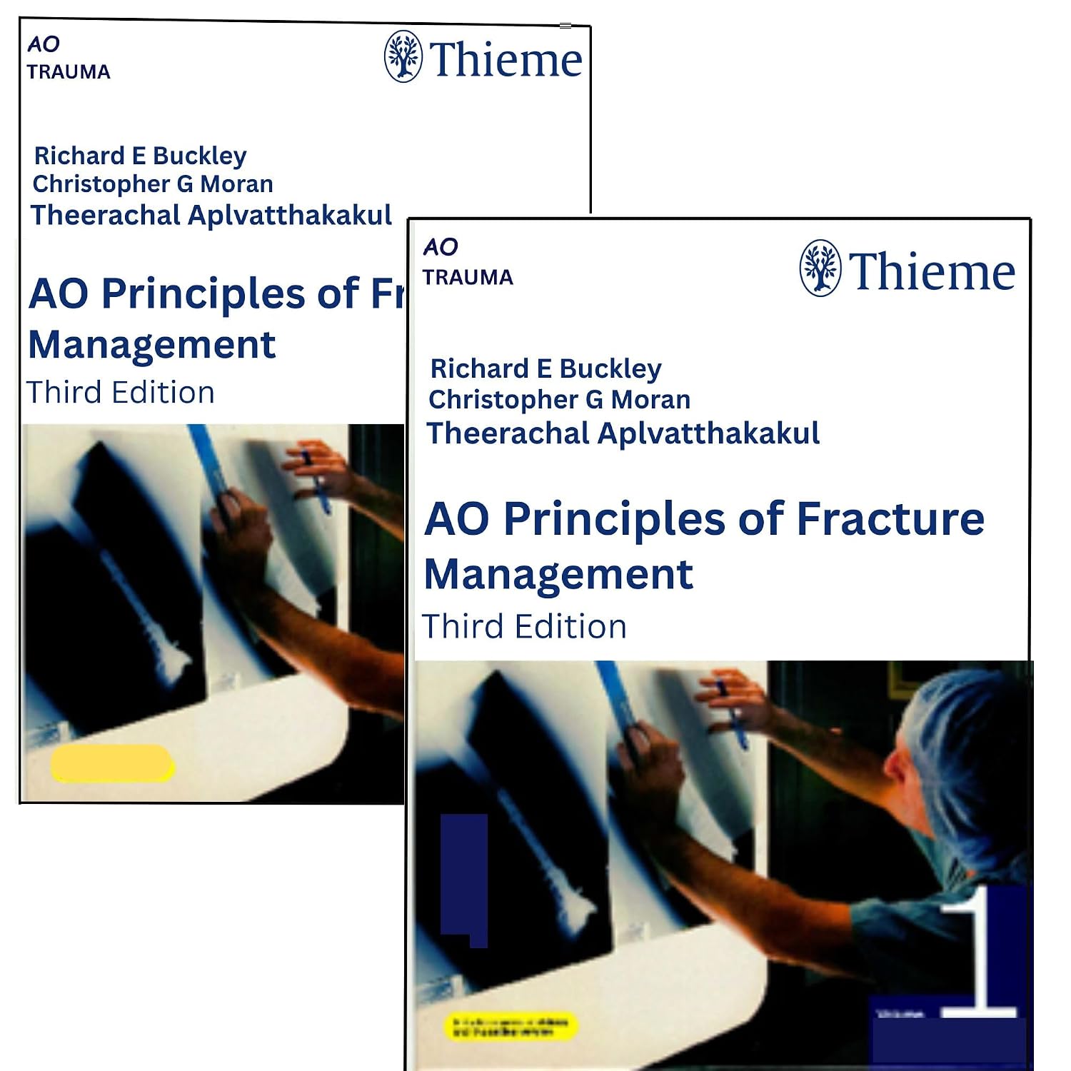 AO-Principles-of-Fracture-Management-3rd-Edition-2-Volume-Set-cdzEo-image