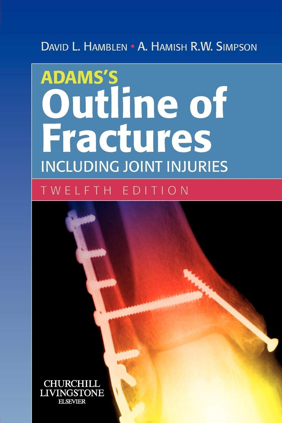 Adamss-Outline-of-Fractures-Including-Joint-Injuries-12th-Edition-4HGU7