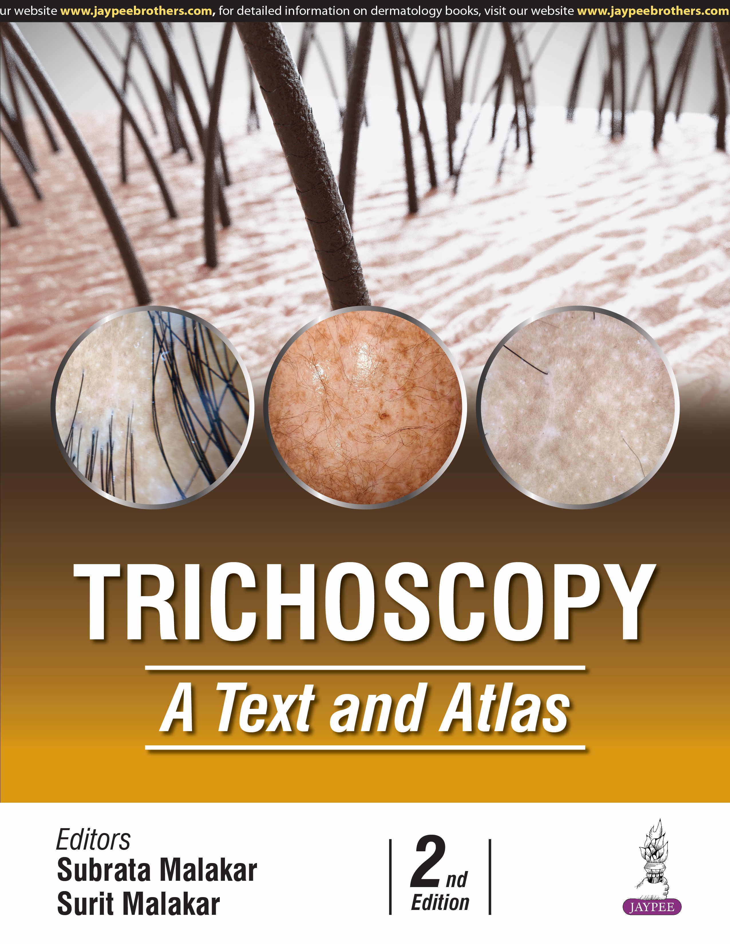 Trichoscopy-A-Text-and-Atlas-2nd-Edition-hKhW6-image
