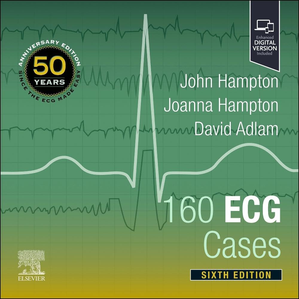 160-ECG-Cases-6th-Edition-NA9cc